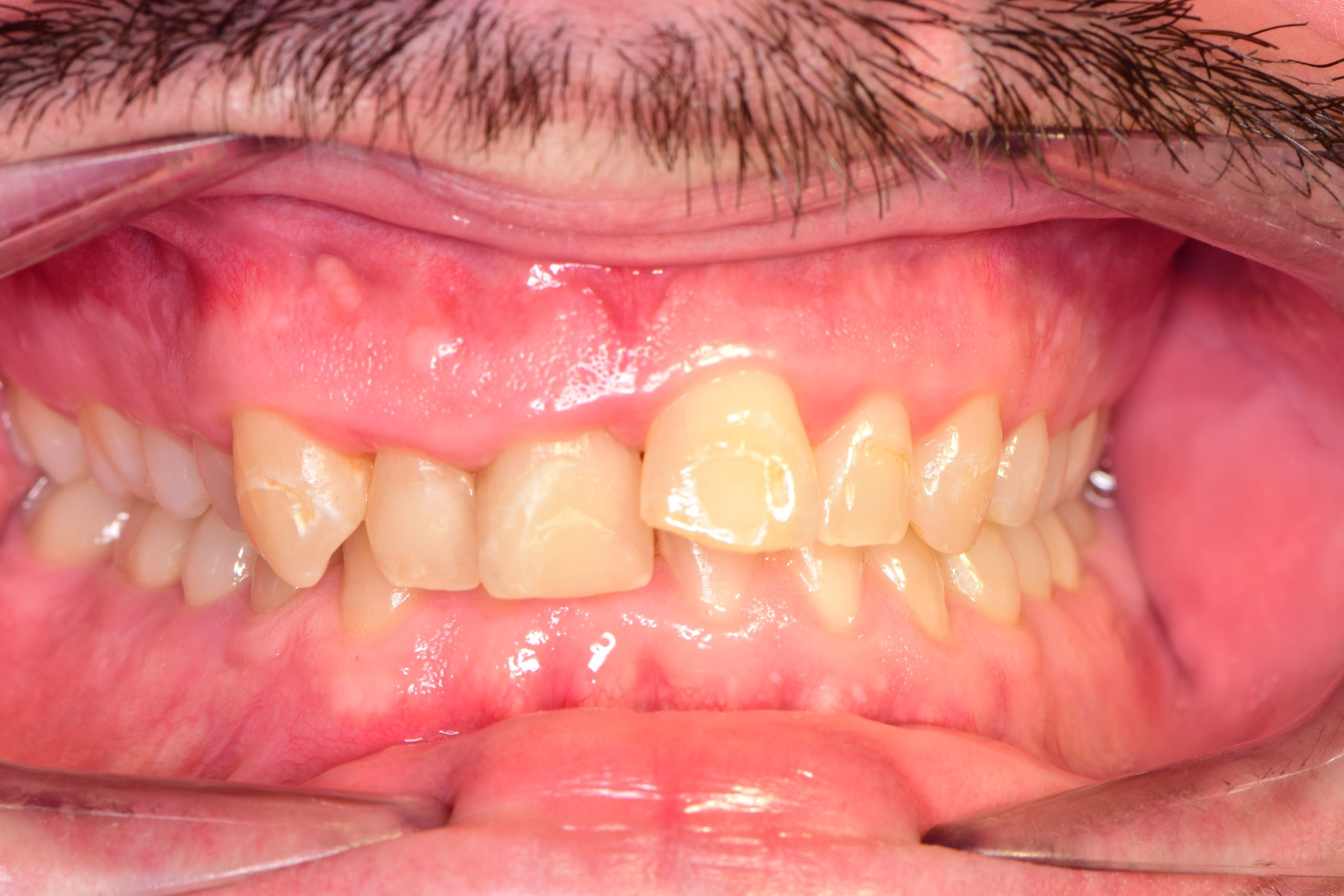 Before image