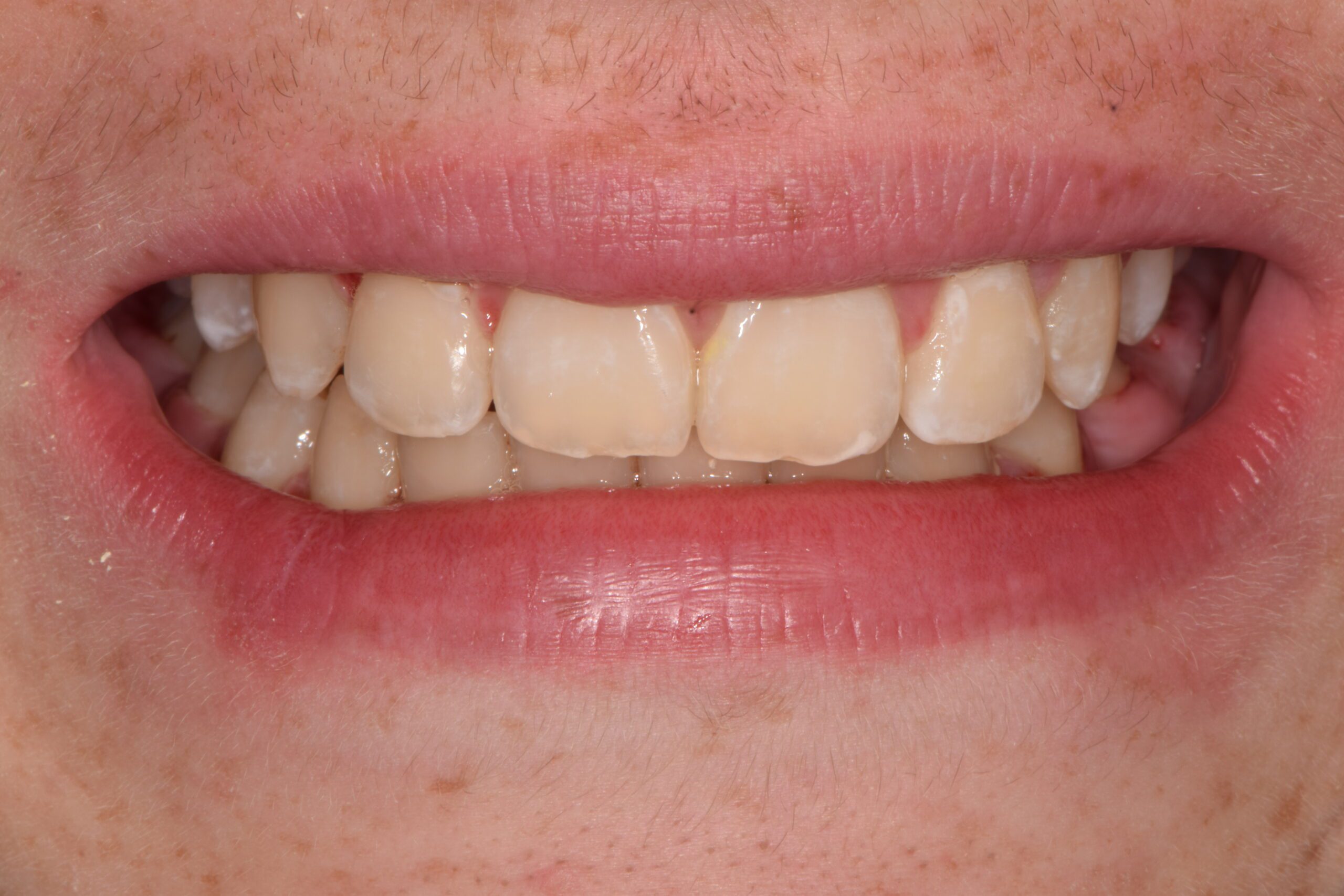 After image