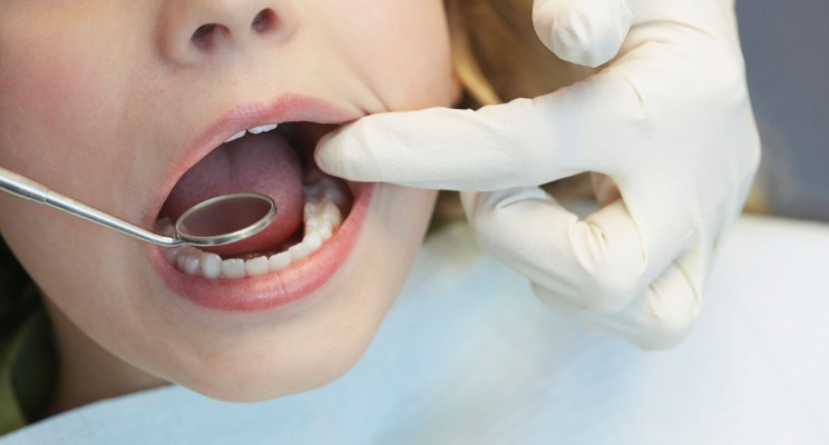 dentista infantil Gijón
