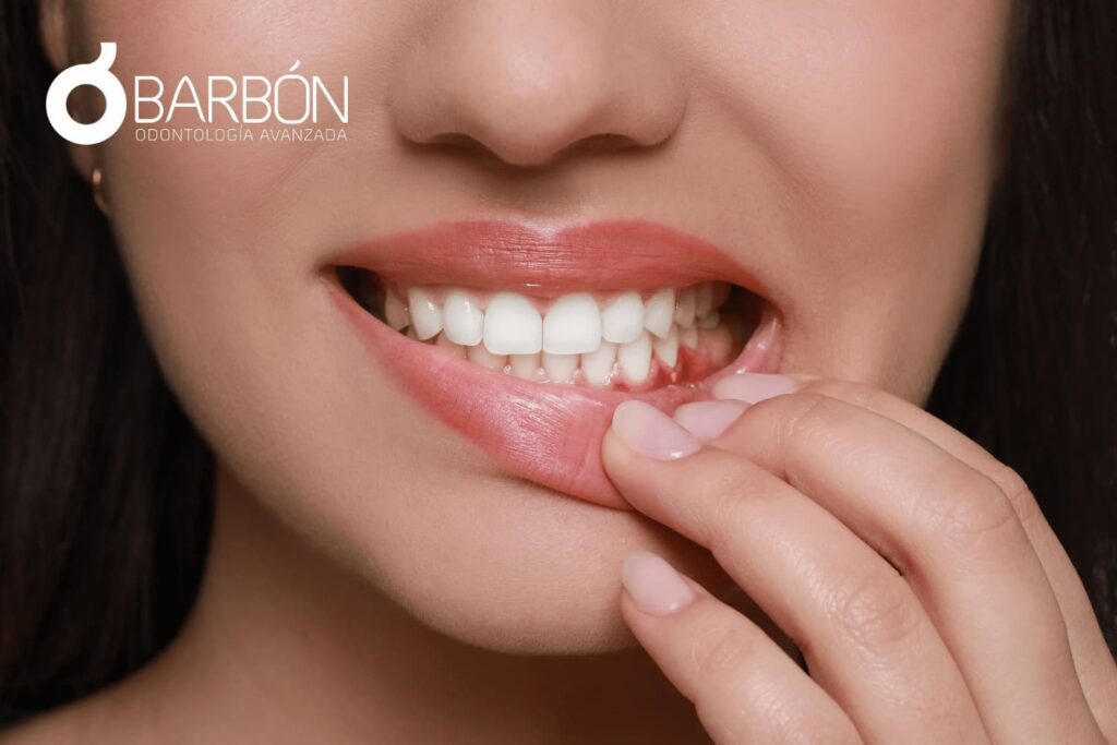 Enfermedad periodontal