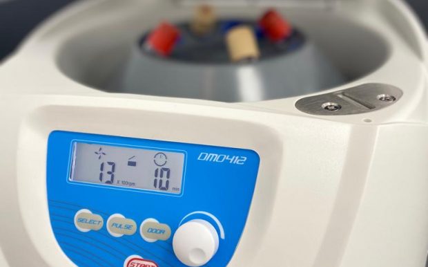 Plasma rico en factores de crecimieno