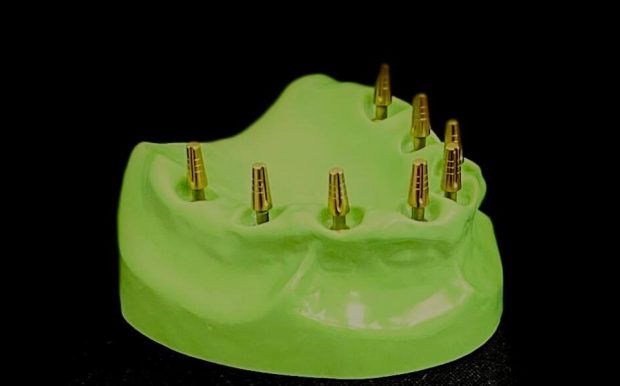 implantes