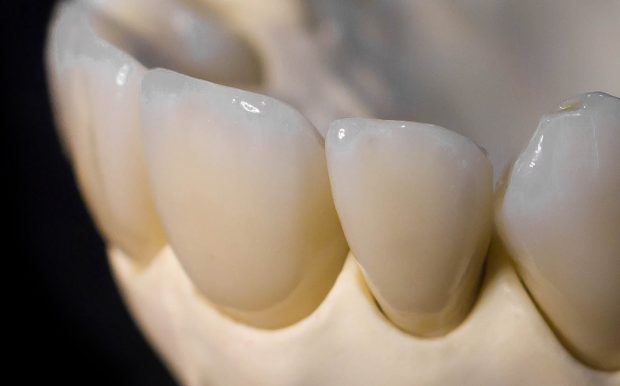 odontología estetica avanzada